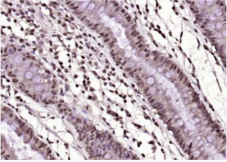 Anti-KLF12 antibody-鋅指轉(zhuǎn)錄抑制因子KLF12抗體,KLF12