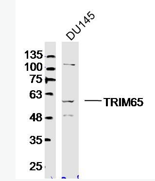 Anti-TRIM65 antibody-TRIM65蛋白抗體,TRIM65