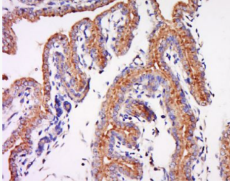 Anti-TRH Receptor antibody-促甲状腺激素释放激素受体抗体,TRH Receptor