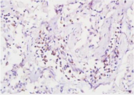 Anti-LASP1 antibody-LASP1蛋白抗体,LASP1