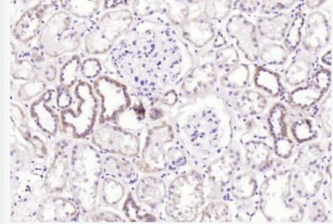 Anti-ATG14 antibody-自噬相關(guān)蛋白14抗體,ATG14