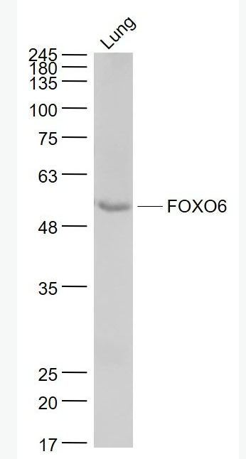 Anti-FOXO6 antibody-叉头蛋白O6抗体,FOXO6