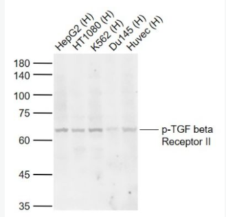 Anti-phospho-TGF beta Receptor II (Tyr259) antibody-磷酸化转移生长因子β受体2抗体,phospho-TGF beta Receptor II (Tyr259)