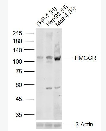 Anti-HMGCR antibody-HMGCR重组兔单抗,HMGCR