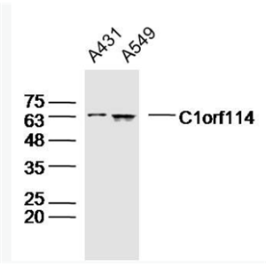 Anti-C1orf114 antibody-1号染色体开放阅读框114抗体,C1orf114