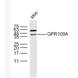 Anti-GPR109A antibody-G蛋白偶联受体109A抗体