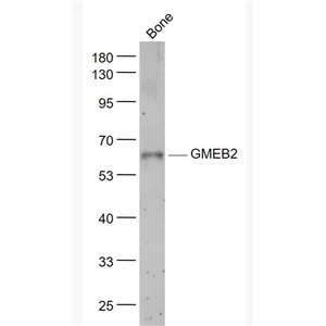 Anti-GMEB2 antibody-糖皮质激素调节元件结合蛋白2抗体,GMEB2