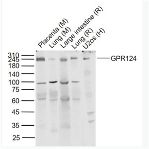 Anti-GPR124 antibody-肿瘤血管内皮标志物/G蛋白偶联受体124抗体