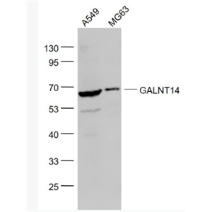 Anti-GALNT14 antibody-GalNAc-T14抗体