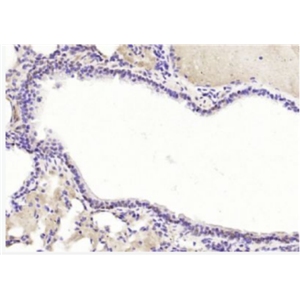 Anti-TRAF6BP antibody-肿瘤坏死因子受体相关蛋白6结合蛋白抗体