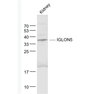 Anti-IGLON5 antibody-IgLON家族蛋白5抗体