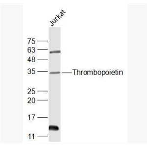 Anti-Thrombopoietin antibody-血小板生成素/巨核细胞集落刺激因子抗体,Thrombopoietin