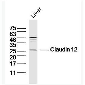 Anti-Claudin 12 antibody-紧密连接蛋白12抗体