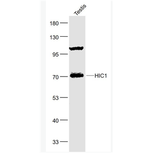 Anti-HIC1 antibody-肿瘤异常甲基化蛋白1抗体,HIC1