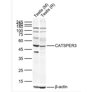 Anti-CATSPER3 antibody-阳离子通道精子相关蛋白3抗体