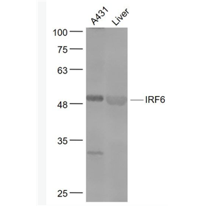 Anti-IRF6 antibody-干扰素调节因子6抗体