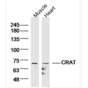 Anti-CRAT antibody-肉毒碱O-乙酰基转移酶,CRAT