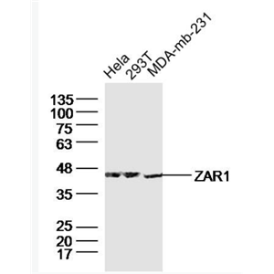 Anti-ZAR1 antibody-受精卵抑制蛋白1抗體