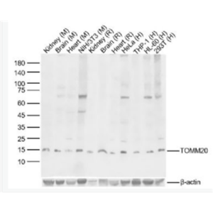 Anti-TOMM20 antibody-线粒体外膜受体Tom20抗体
