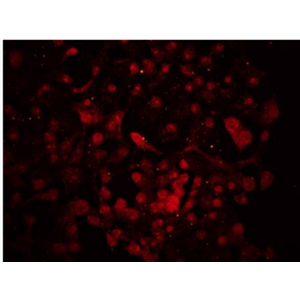 Anti-DACT1 antibody-肝癌新基因3蛋白抗体