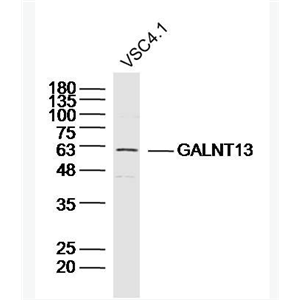 Anti-GALNT13 antibody-多肽N-乙酰氨基半乳糖转移酶13抗体
