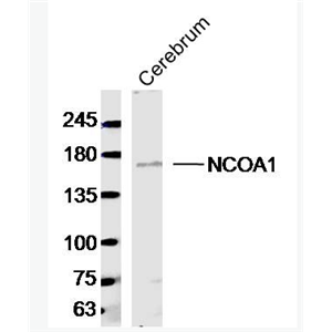 Anti-NCOA1/KAT13A antibody-核受体共激活剂1抗体