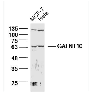 Anti-GALNT10 antibody-多肽N-乙酰氨基半乳糖转移酶10抗体