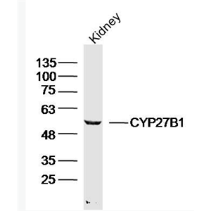 Anti-CYP27B1 antibody-细胞色素P450 27B1抗体