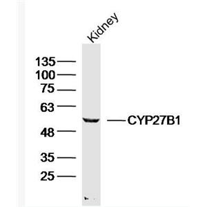 Anti-CYP27B1 antibody-细胞色素P450 27B1抗体,CYP27B1