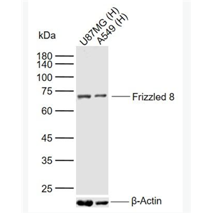 Anti-Frizzled 8antibody-卷曲蛋白8抗体