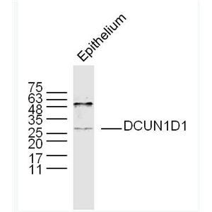 Anti-DCUN1D1 antibody-鳞状细胞癌相关蛋白抗体