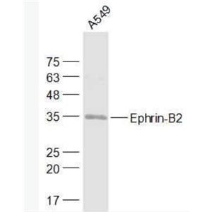 Anti-Ephrin-B2  antibody-Ephrin-B2抗体