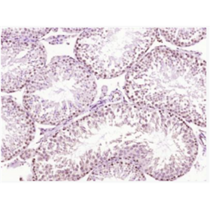 Anti-SCP3 antibody-膽堿磷酸轉(zhuǎn)移酶1抗體