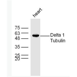 Anti-Delta 1 Tubulin antibody-微管蛋白δ1/δ Tubulin抗体