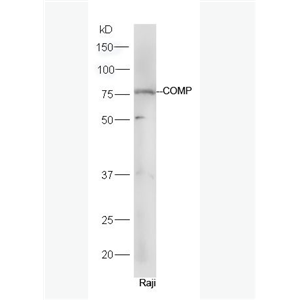 Anti-COMP antibody-软骨寡聚基质蛋白抗体