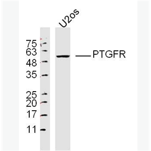 Anti-PTGFR antibody-前列腺素F2a受体抗体PGF2αR,PTGFR