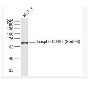 Anti-phospho-C-REL (Ser503) antibody-磷酸化淋巴细胞衍生C-型凝集素抗体