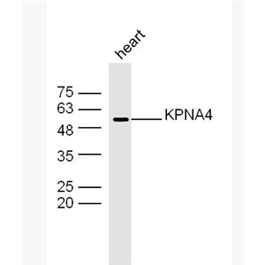 Anti-KPNA4 antibody-KPNA4蛋白抗体,KPNA4