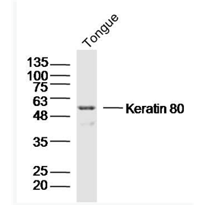Anti-Keratin 80 antibody-细胞角蛋白80抗体