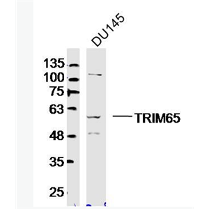 Anti-TRIM65 antibody-TRIM65蛋白抗體