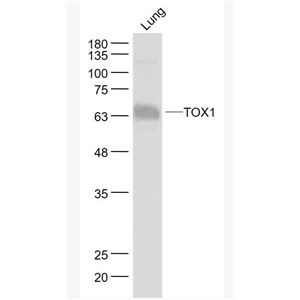 Anti-TOX1 antibody-胸腺高迁移率族蛋白TOX抗体,TOX1