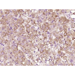 Anti-HSD3B2 antibody-3β-羟基类固醇脱氢酶/δ5->4-异构酶2型抗体,HSD3B2