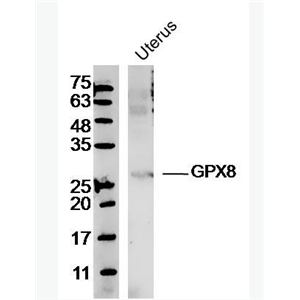 Anti-GPX8 antibody-谷胱甘肽过氧化物酶8抗体,GPX8