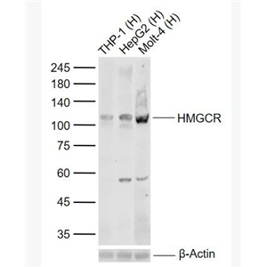 Anti-HMGCR antibody-HMGCR重组兔单抗