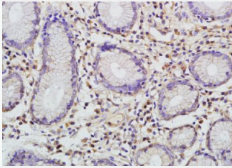 Anti-I-309/CCL1 antibody-嗜酸粒细胞趋化蛋白CCL1抗体,I-309/CCL1