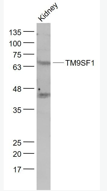 Anti-TM9SF1 antibody-跨膜蛋白超家族9-1抗體,TM9SF1