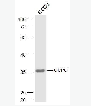 Anti-OMPC antibody-大肠杆菌外膜孔道蛋白C抗体,OMPC