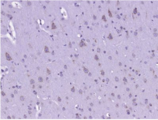 Anti-CARD12 antibody-凋亡加強(qiáng)結(jié)構(gòu)域蛋白12抗體,CARD12