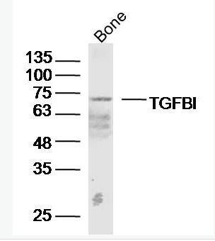 Anti-TGFBI antibody-角膜上皮蛋白TGFBI抗体,TGFBI