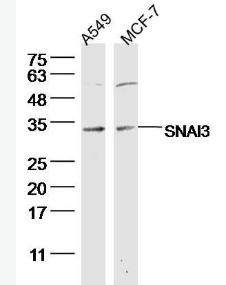 Anti-SNAI3 antibody-锌指蛋白293抗体,SNAI3